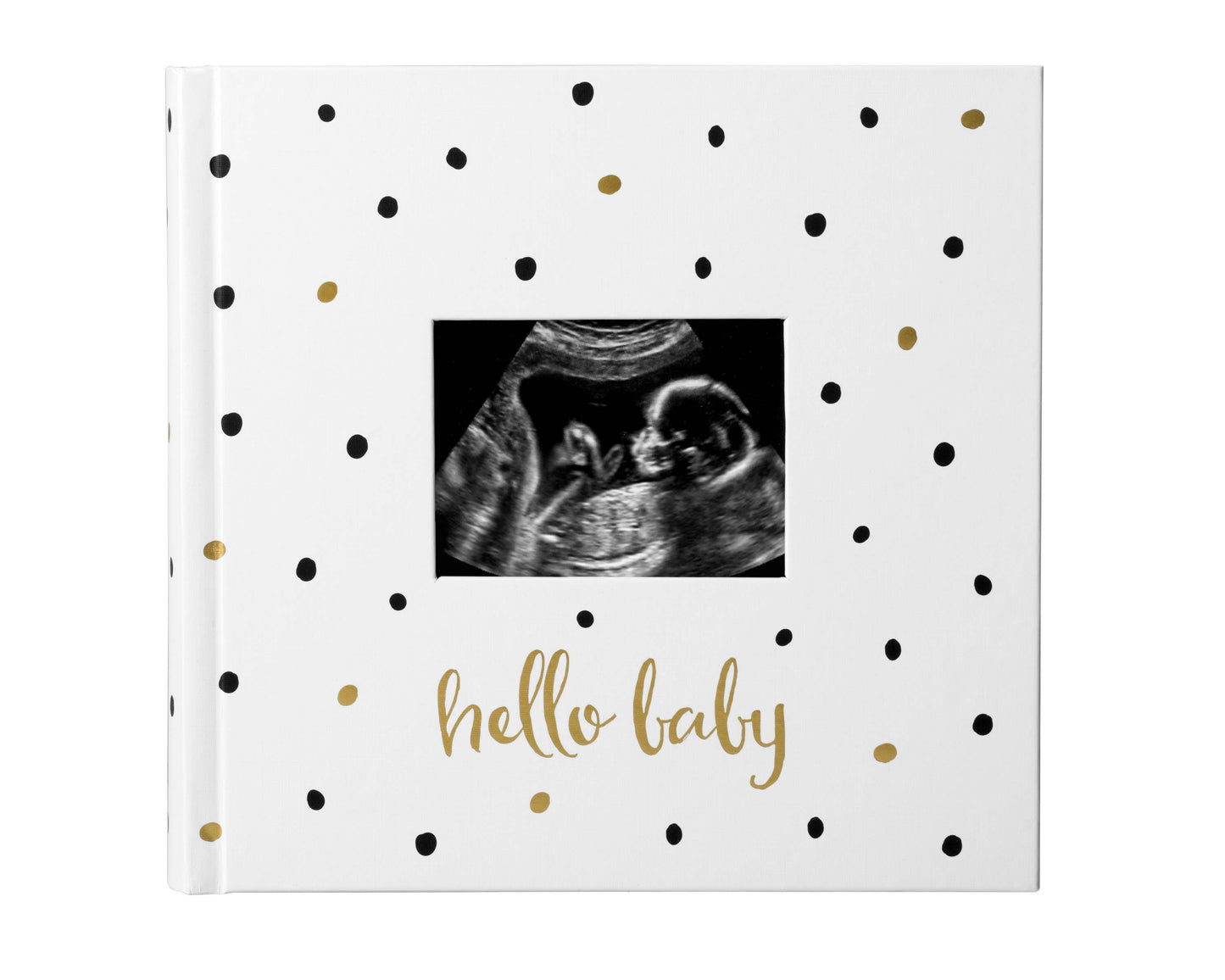 Baby Photo Album with Guided Journal Pages